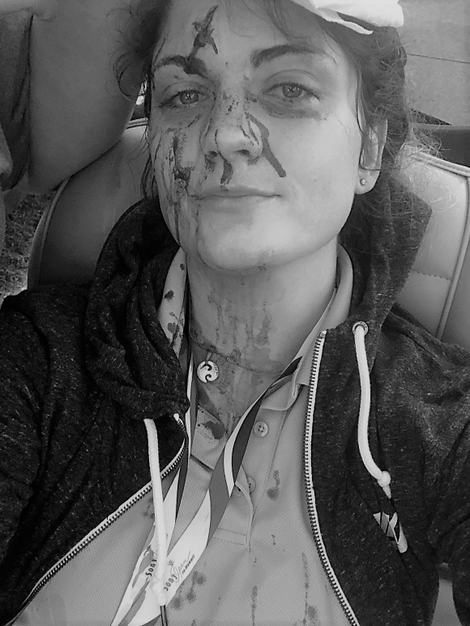 Marstella got over twenty stitches for her trouble.